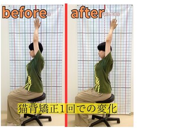 きずな鍼灸整骨院 武蔵ヶ丘本院/猫背矯正