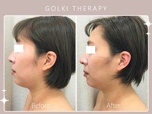 シロカネ 光の森店(SHIROKANE)/韓国式小顔コルギ☆