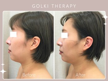 シロカネ 光の森店(SHIROKANE)/韓国式小顔コルギ☆