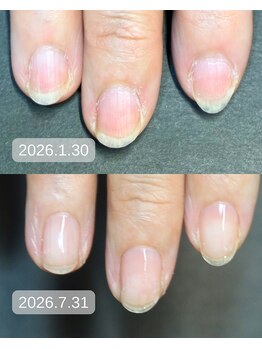 キラリネイル(KIRARINAIL)/お客さまの変化