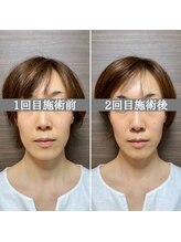 シェア 人形町店(Chare)/【小顔・骨盤矯正・О脚・整体】