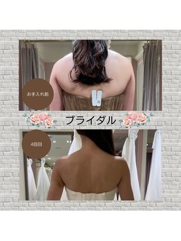 ディア スプリーマ/ブライダルエステ★4回目の効果