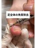 【足のトラブルはおまかせ♪】フットケア￥7,900