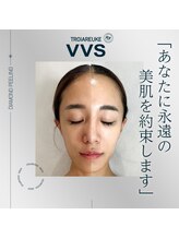 サロン ド セイ(Salon de SEI)/VVSダイヤモンドピーリング