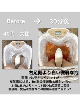 エルプラス(L+)/フッドデトックス　3