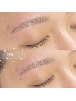 ビュー(V.I.E.W)/HBL