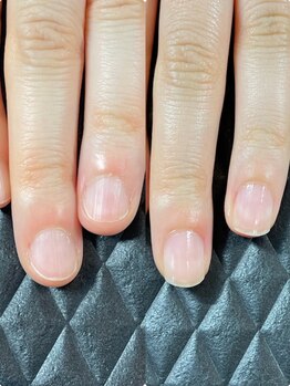 クーラ アンド ベリッシモ(Cura&Bellissimo)の写真/《極上の癒し時間♪》人前で見せるのが恥ずかしい指先を自慢できる指先に!深爪/貝爪/ちび爪/噛み爪も解決◎