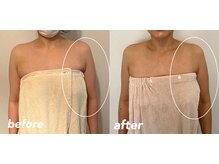 リラクゼーションエステ アジュール(Azur)/【施術10回】