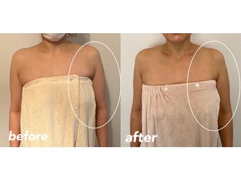 リラクゼーションエステ アジュール(Azur)/【施術10回】