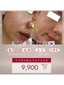 韓国発本気の肌管理【肌質改善×ツヤ爆誕コース】インセルダムフェイシャル