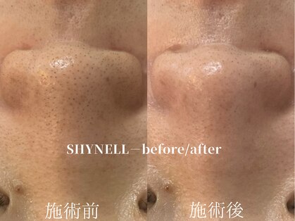シャイネル(SHYNELL)の写真