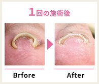 一宮巻き爪センター