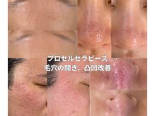 んまちの雰囲気(【谷四/天満橋】プロセルセラピーズで肌悩み改善)