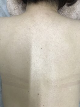 ナノハナ/鹿沼市本格全身脱毛ナノハナ