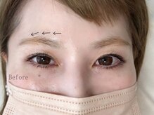 アマリリス(Amaryllis)/ハリウッドブロウリフト(HBL)