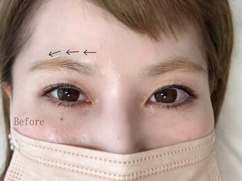 アマリリス(Amaryllis)/ハリウッドブロウリフト(HBL)