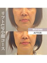 シーズボーテ(C's Beaute)/満足度はやっぱりフルコース♪