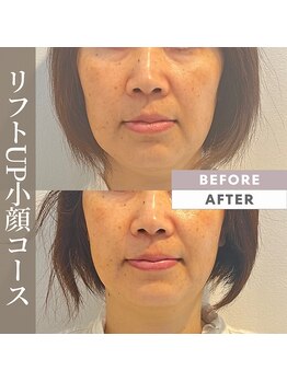 シーズボーテ(C's Beaute)/満足度はやっぱりフルコース♪