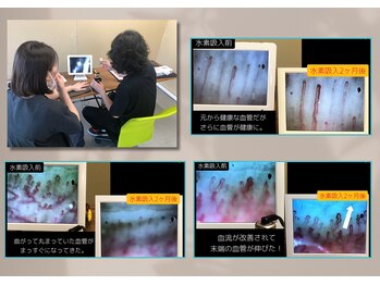 ユトレ(yutre)/水素吸入をスタッフが2ヶ月検証