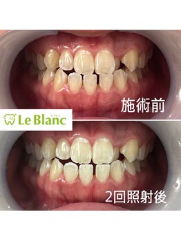 ルブラン 奈良店(Le Blanc)/頻繁に通えない方にもオススメ!