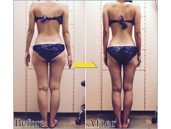 整体 美容サロン フェールラヴィ/【整体+痩身】