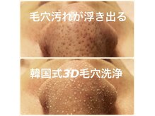 アムズ(Am’s)の雰囲気（【韓国式3D毛穴洗浄】毛穴刺激のない最新施術！黒ずみ原因改善♪）