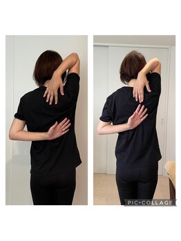 ビーラボ(Be Lab)/筋膜矯正 施術Before→After