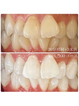 ホワイトニングルーム 川崎店(WhiteningRoom)/ホワイトニング/川崎