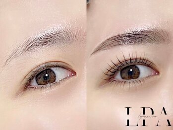 レピア 郡山駅前店/韓国式LEPIA Before&After