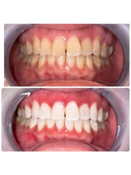 コナホワイトニング 神保町/セルフホワイトニング神保町