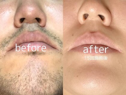 トータルビューティケア アヤ(Aya)の写真