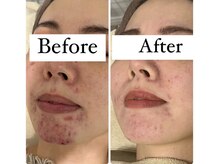 エルア 尼崎(Elua)/