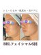 ルアナライフ(Luana Life)の写真/AI肌分析で今のお肌を細かく診断!BBL光はIPL光の約5倍の美容効果で首や鎖骨もケア♪