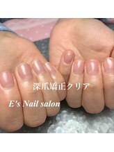 イーズ(E's)/深爪矯正クリア