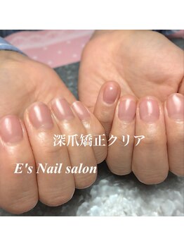 イーズ(E's)/深爪矯正クリア