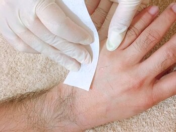 ブラジリアンワックス脱毛サロン リアンジュ(Rienge)/メンズワックス脱毛 【手の甲】