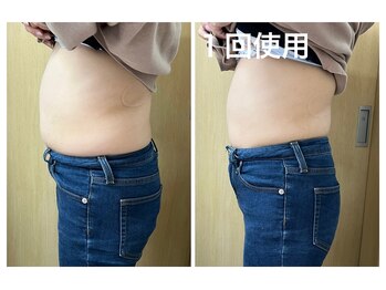 マイティー整骨院 ココア(CoCoa)/痩身マシン