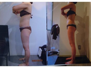 パーフェクトボディプレミアム 札幌駅前店(PERFECT BODY PREMIUM)/お客様　ビフォーアフター（16）