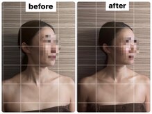 ライズサロン(RiseSALON)/リンパマッサージ&ヘッドスパ