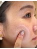 徹底♪　50代からのマイルド芸能人ピール◎高保湿肌トラブル緩和　初回限定