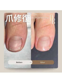 パズルリングネイル(Puzzle.ring Nail)/欠けた爪の修復