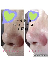 サロン ド スー(Salon de Suu)/ハイドロヴィーナス