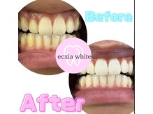 エクシアホワイトニング 明石店/ホワイトニング体験/記念写真