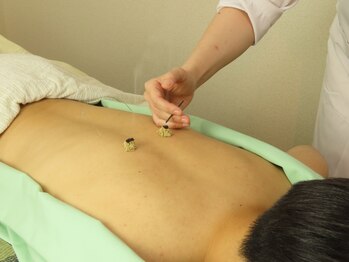 鍼灸ねこの手 高輪の写真/日々の疲れをしっかりとり、心も身体も本来の自分に。また明日から乗り越えていけるお身体へと導きます！