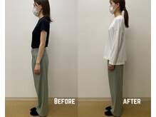 タイコ接骨院 栄本店/【姿勢改善BeforeAfter】
