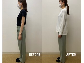 タイコ接骨院 栄本店/【姿勢改善BeforeAfter】