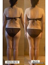 シエスタ リラクゼーションアンドデトックス(Siesta Relaxation&Detox)/50代のお客様のビフォーアフター