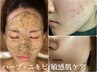 OPEN記念☆≪ニキビ・敏感向け≫肌質改善コース※ホームケア付￥22000→￥13300
