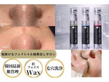 エトレ(ETOLE)の写真
