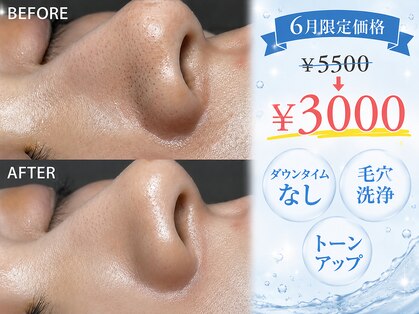 オンフリーク(ON FLEEK)の写真